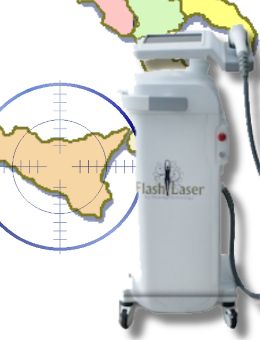 Laser Diodo Sicilia epilazione