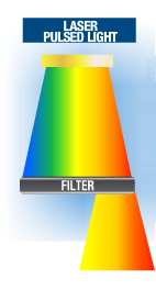 laser diodo vs luce pulsata